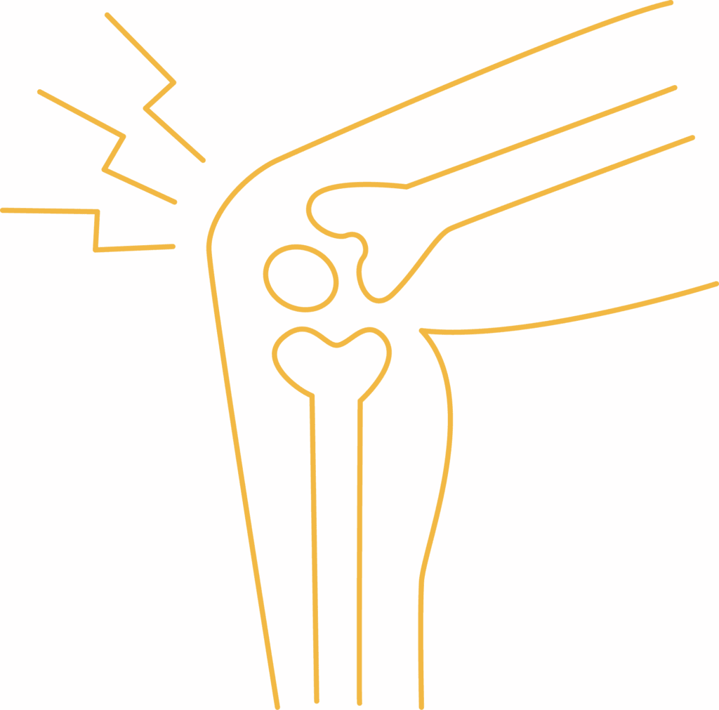 Icon of a bent knee joint with lines indicating pain
