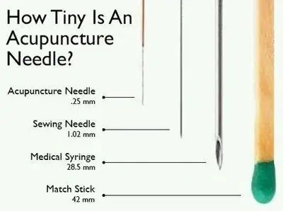 acupuncture needle